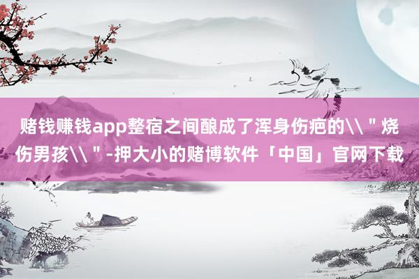 赌钱赚钱app整宿之间酿成了浑身伤疤的\＂烧伤男孩\＂-押大小的赌博软件「中国」官网下载
