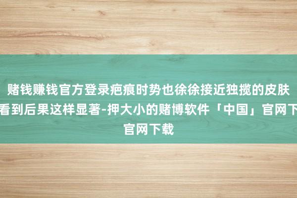 赌钱赚钱官方登录疤痕时势也徐徐接近独揽的皮肤！看到后果这样显著-押大小的赌博软件「中国」官网下载